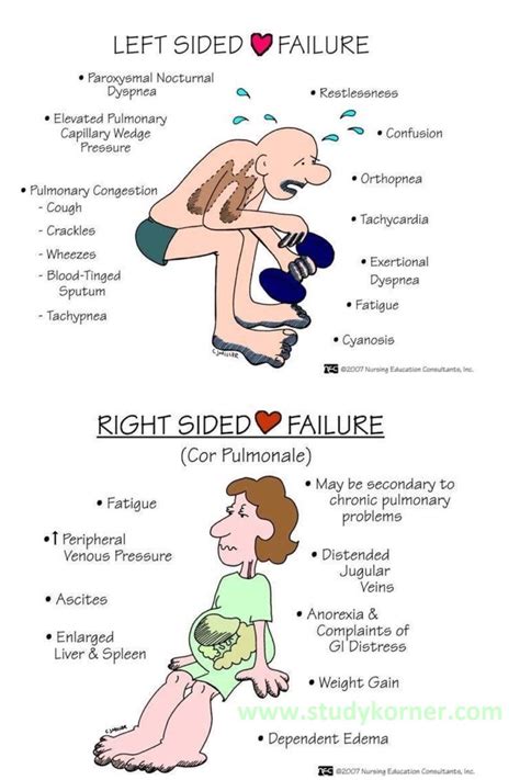 lv heart failure symptoms|left sided heart failure picturesattrcm.